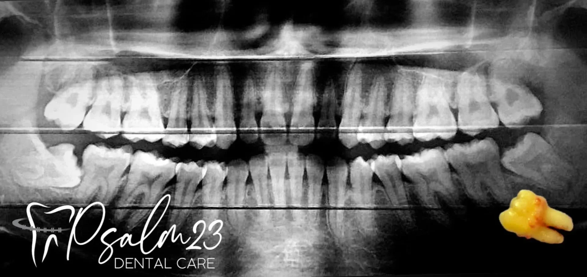 Psalm23 Dental Care oral surgery services — photo 3